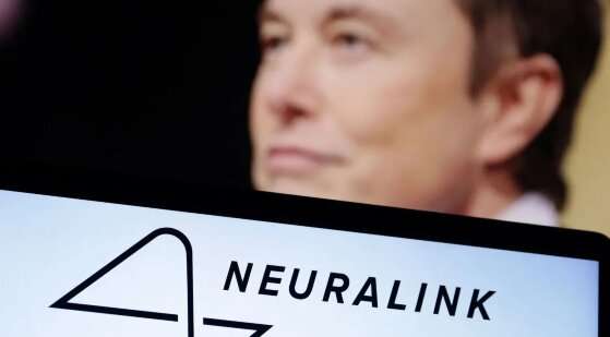 Neuralink Faz 1º Implante De Chip Cerebral Em Humano Declara Elon Musk